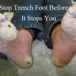 Stop Trench Foot Before It Stops You (Bug Out Crisis!)