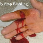 Quickly Stop Bleeding