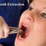 DIY Tooth Extraction