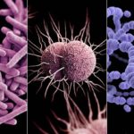 The Most Likely Infections We Will Battle Post SHTF